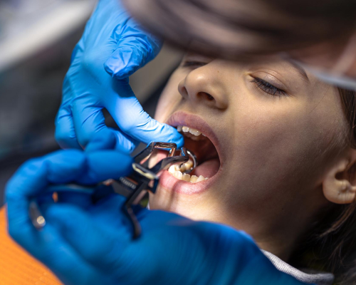 smiley-dental-lowell-same-simple