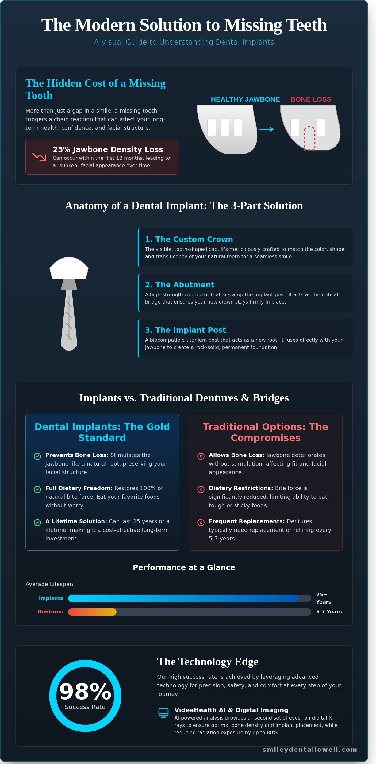 Dental Implants in Lowell, MA: The Complete Guide to Restoring Your Smile