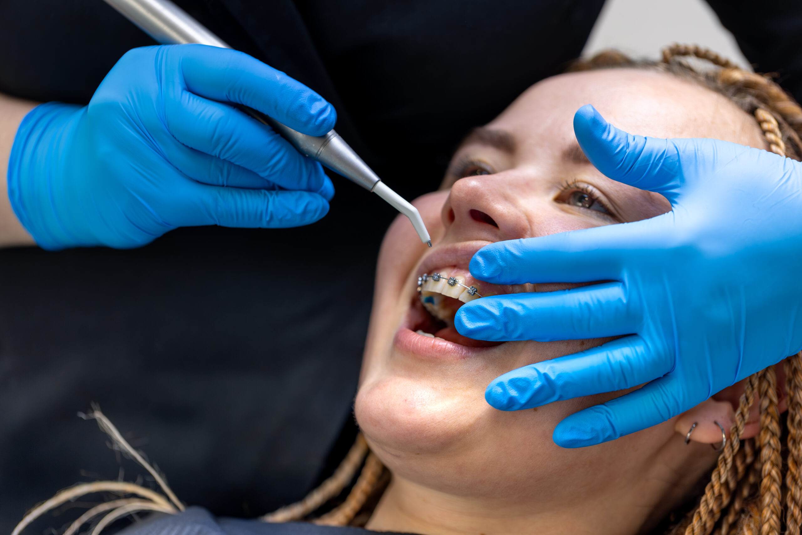 full mouth dental implants