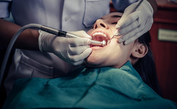 Deep Teeth Cleaning