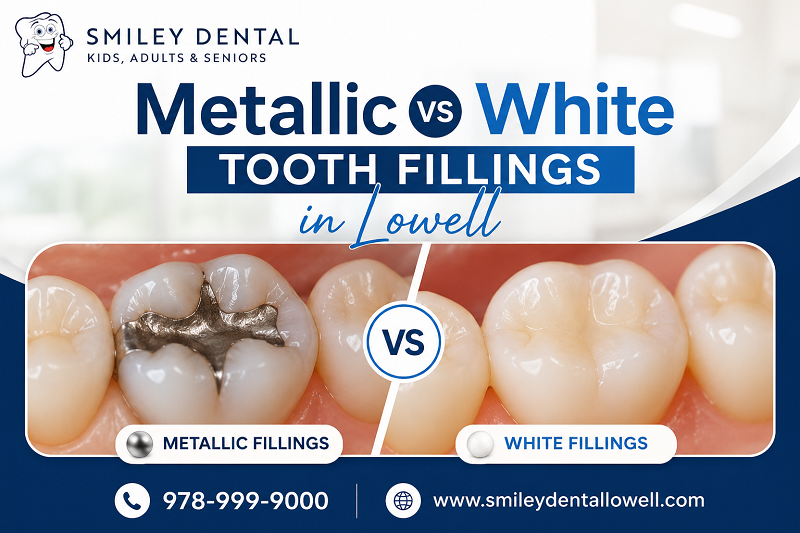 Metallic vs White Tooth Fillings in Lowell