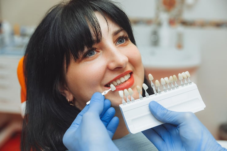 Professional Teeth Whitening