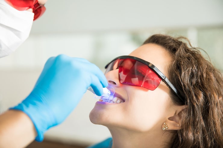 Professional Teeth Whitening vs At-Home Kits