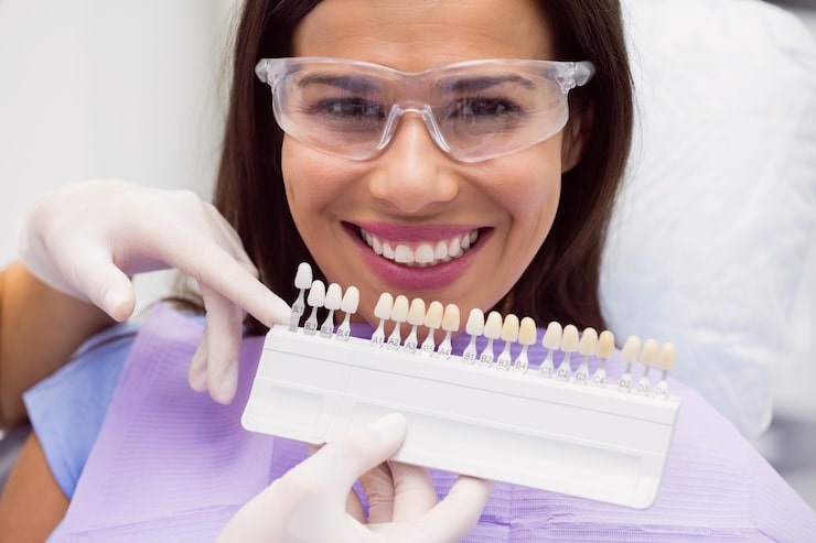 Professional Teeth Whitening