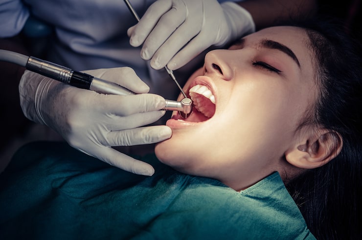 Periodontal Disease Surgery in Lowell