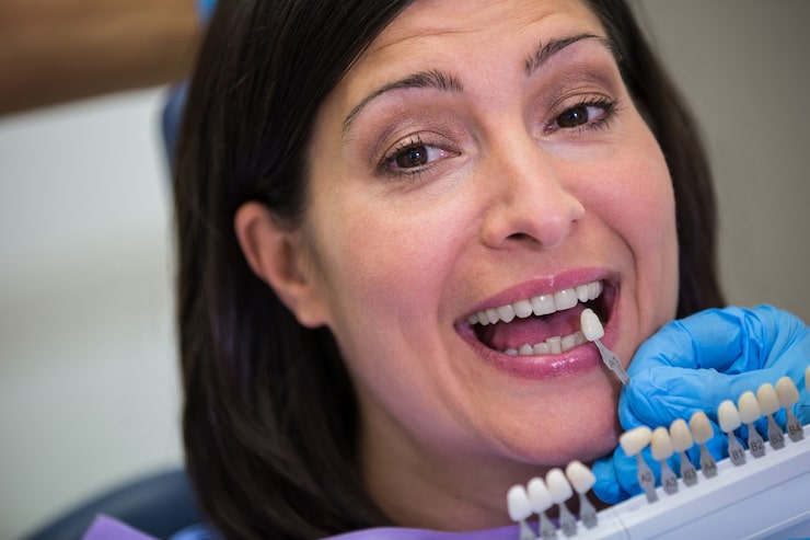 Dental Implants for Missing Teeth