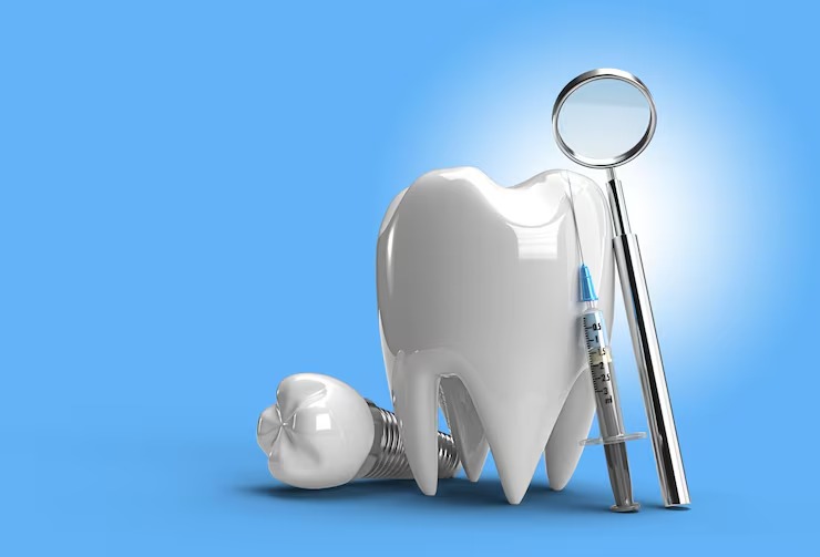 Mouth Dental Implants Cost