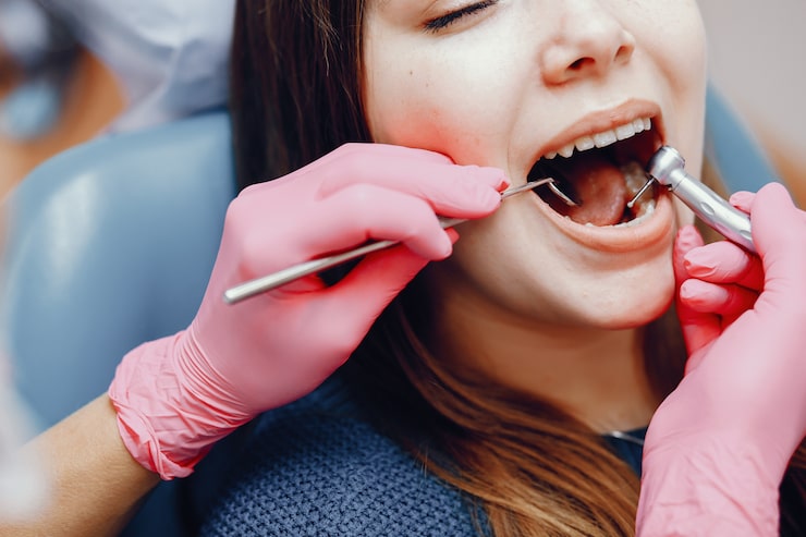 Composite Fillings vs Amalgam Fillings