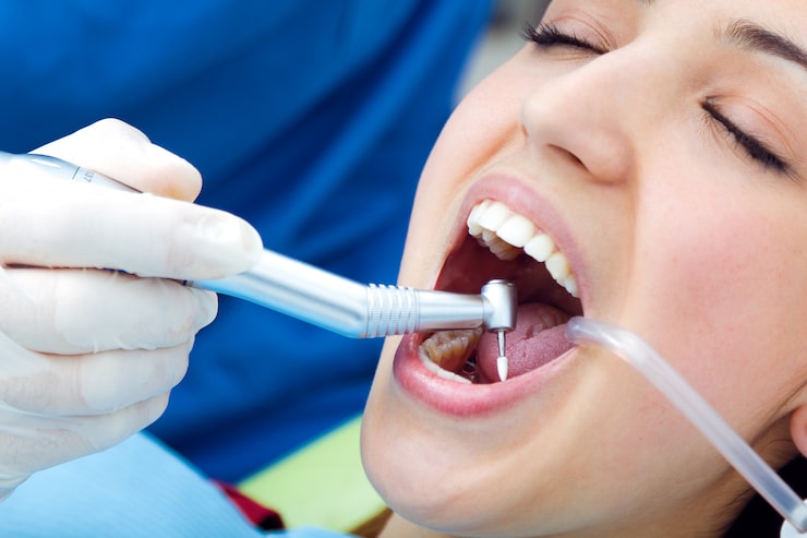 Deep Teeth Cleaning